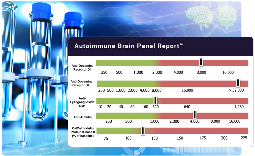 Autoimmune Brain Panel