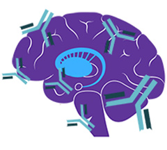 TARGET BASAL GANGLIA